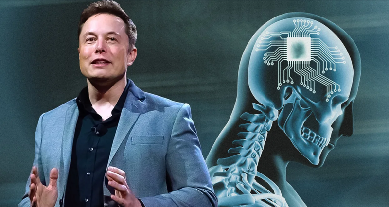 Neuralink, beyin çipi testlerine başlıyor